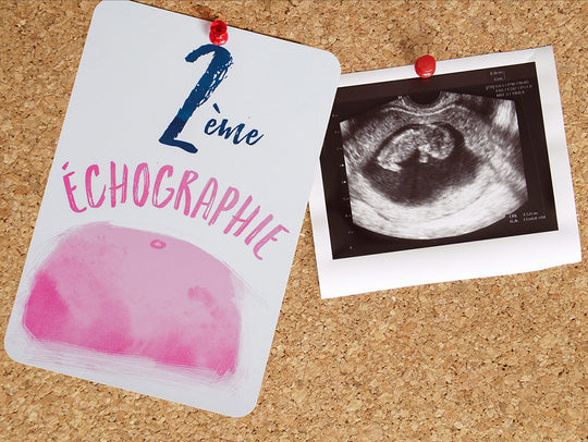 Carte Etape Echographie